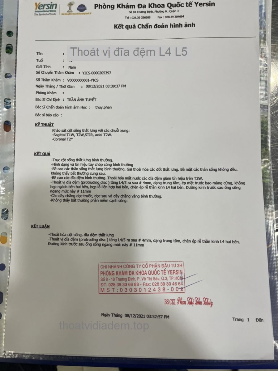 Thoát vị đĩa đệm L4-L5